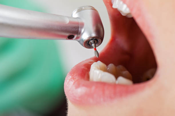Best Urgent Tooth Repair  in Penn Farms, PA